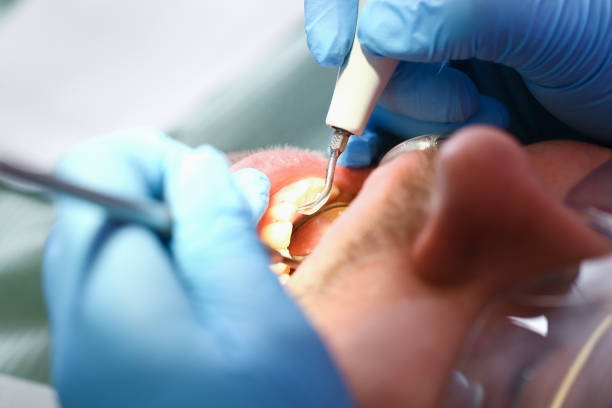 Best Weekend Emergency Dentist in Mascoutah, IL