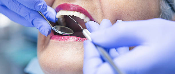 Best Emergency Dental Care for Broken or Chipped Teeth in Mascoutah, IL